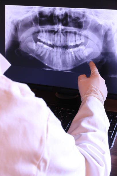 Best Emergency Treatment for Dental Infections or Abscesses in Crestwood Village, NJ
