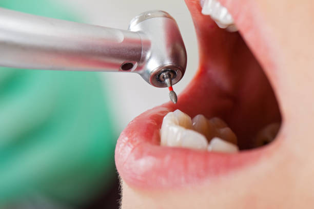 Best Emergency Gum Treatment in Crestwood Village, NJ